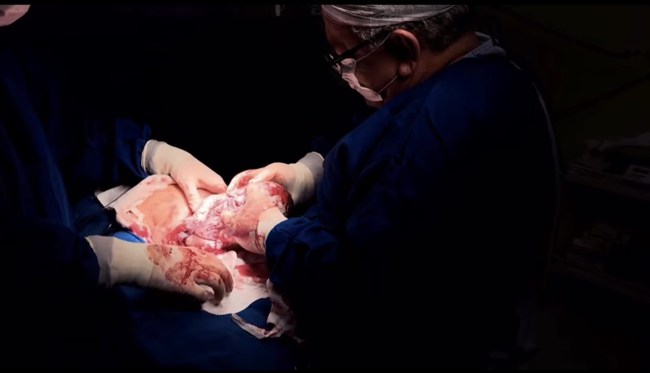 Dr. Antônio realizando o parto de um bebê